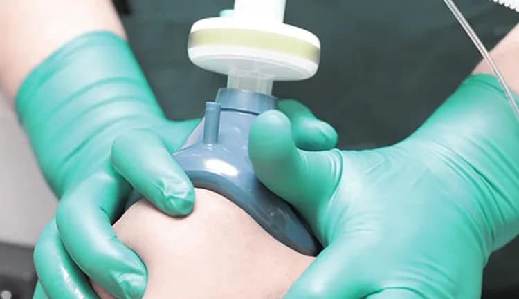 Medical grade nitrous oxide 4 Doctor administering medical grade nitrous oxide with oxygen mask to patient in hospital
